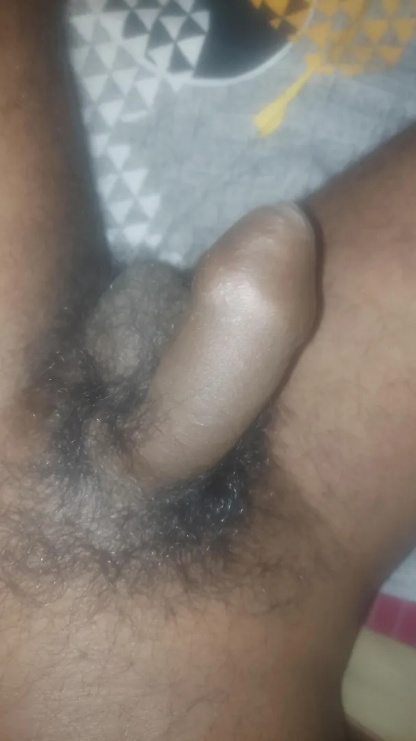 Pubes posted by [deleted]