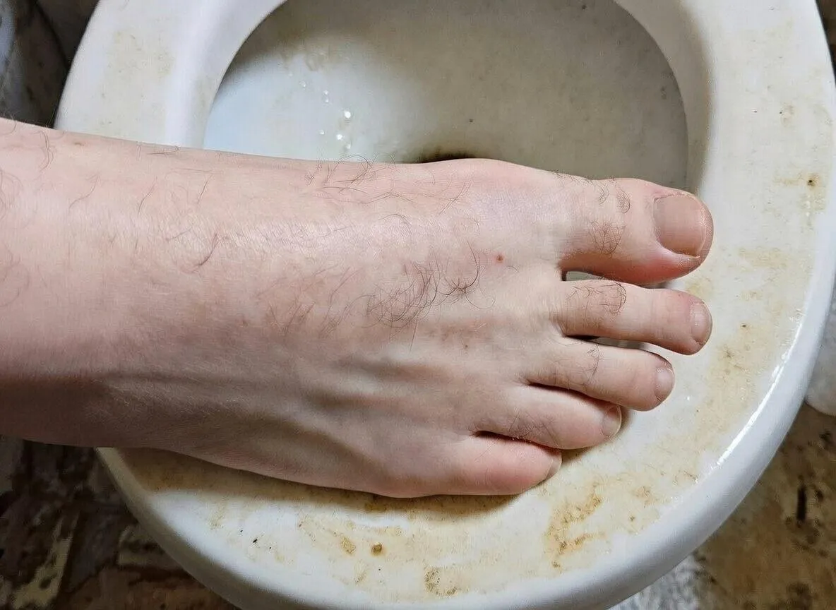 Pure skin. Wrong place. posted by frenchmalefeet74