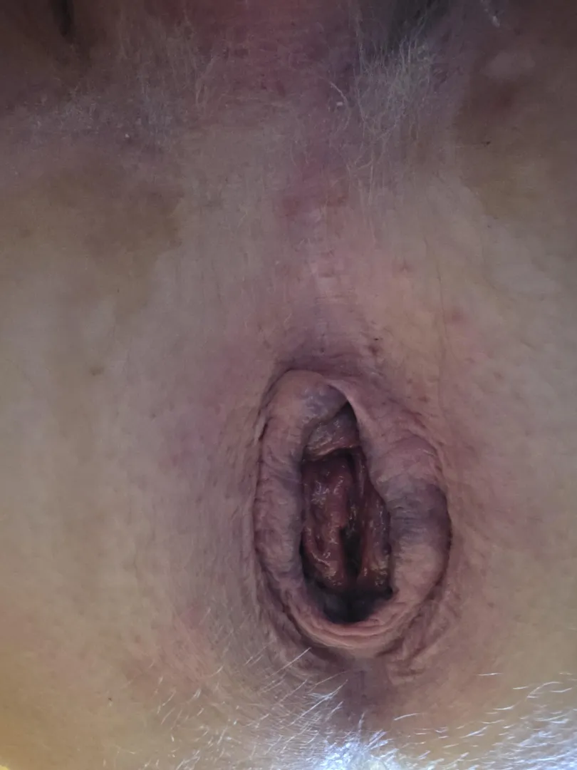 Really gaped posted by juanwilbur