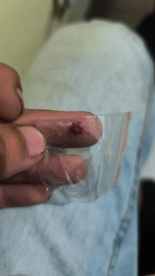 Relatos desse micro? by Fearless-Bluejay-728