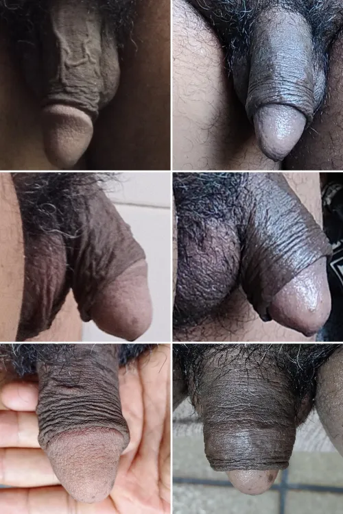 Resultados após oito meses by Fit-Patient-4777