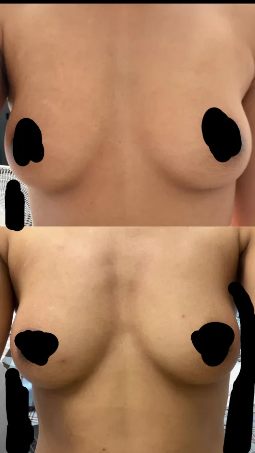 ? Results idk by thinkingabouttokyo