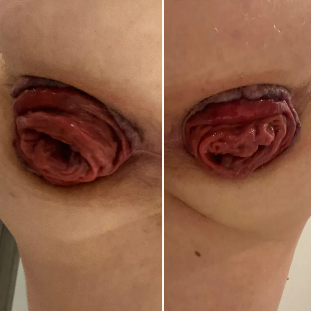 Right side or left side? posted by BrokenEhHole