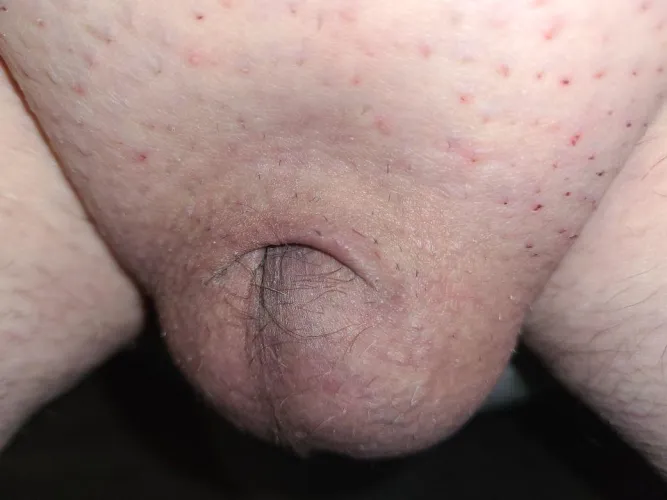 Safely tucked away by Acrobatic-Effect9781