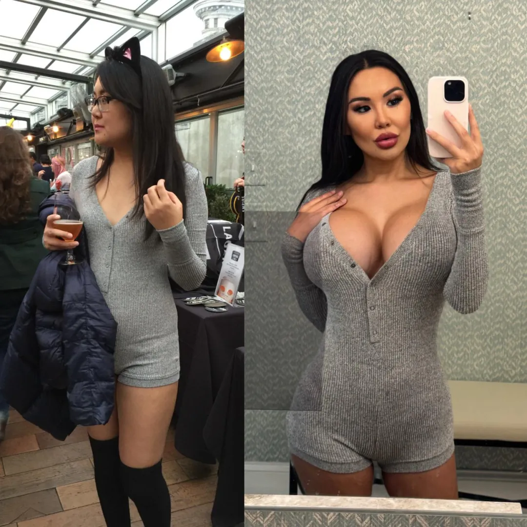 Same outfit, new overfilled 1300cc tits posted by nancydollxo