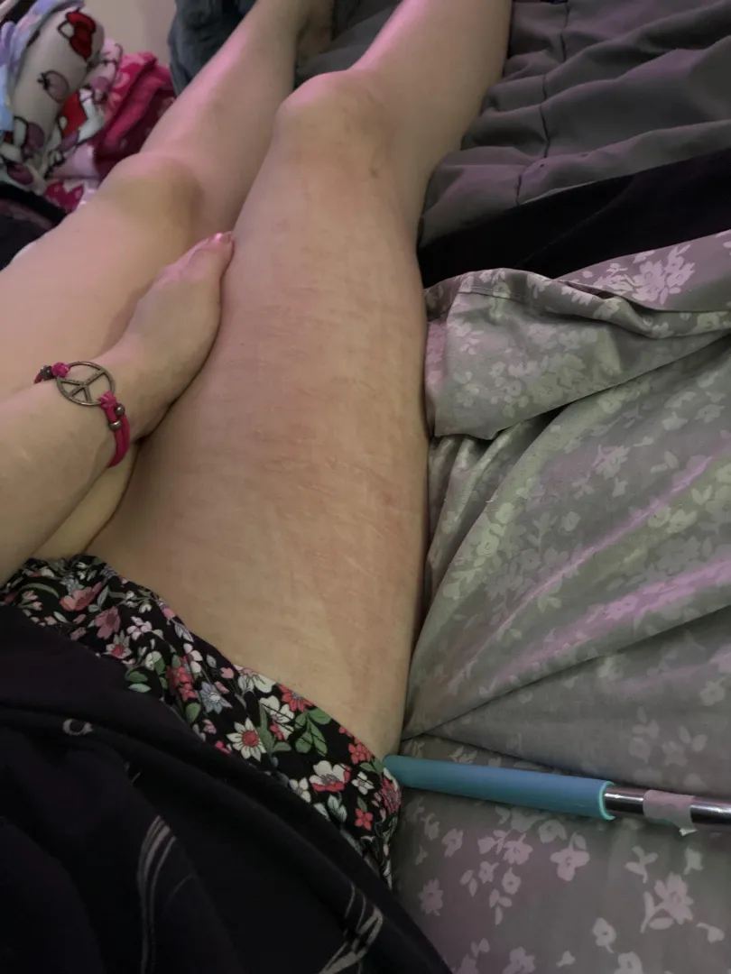 Scars for days posted by sp00kybxby