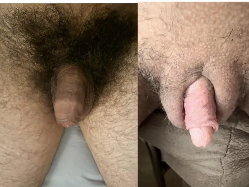 Seeing double posted by Hopeful-Snow-9060