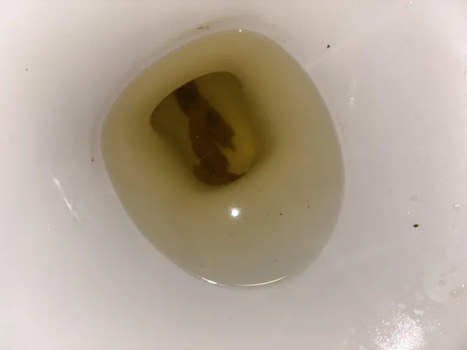 SELLING SCAT DROPBOX $65  SCAT TELEGRAM $95 by Bossbitch4eva