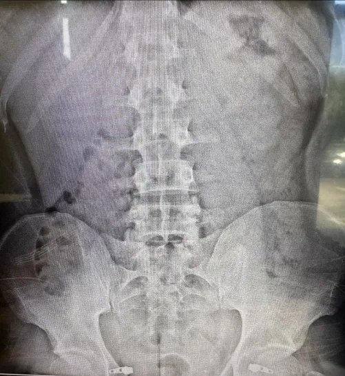 Severe Constipation by GoddessCeresSlave