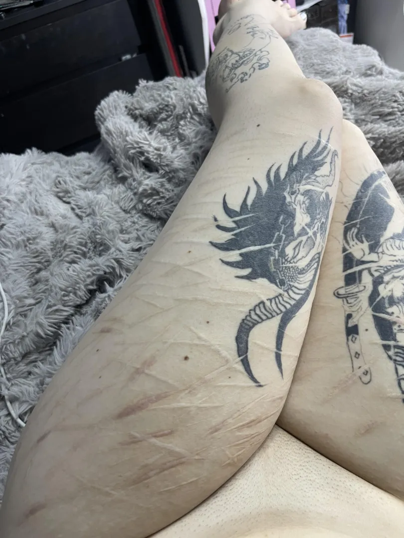 sexy scars on goth girl >< posted by bubblyHips