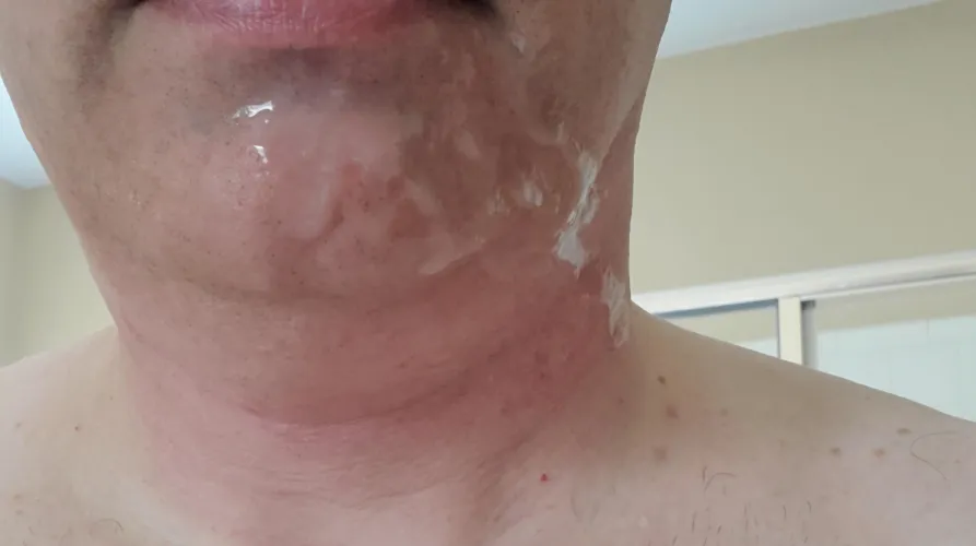 Shot my chin by Justhere2watch73