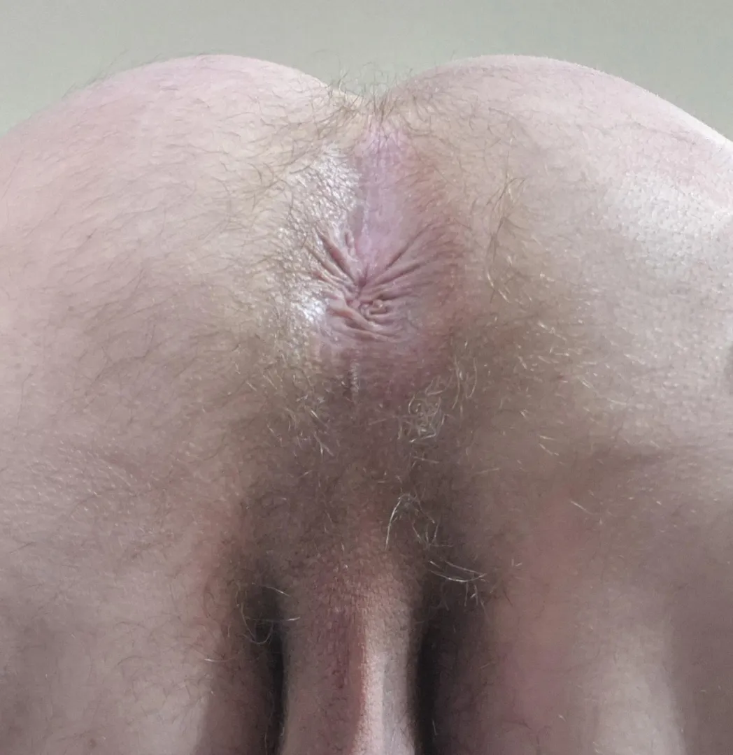 Should I shave posted by No-Memory-7407