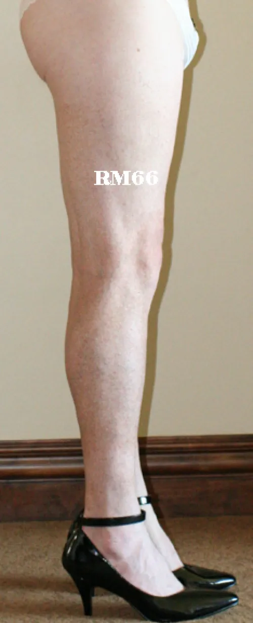 Side view only by rm66