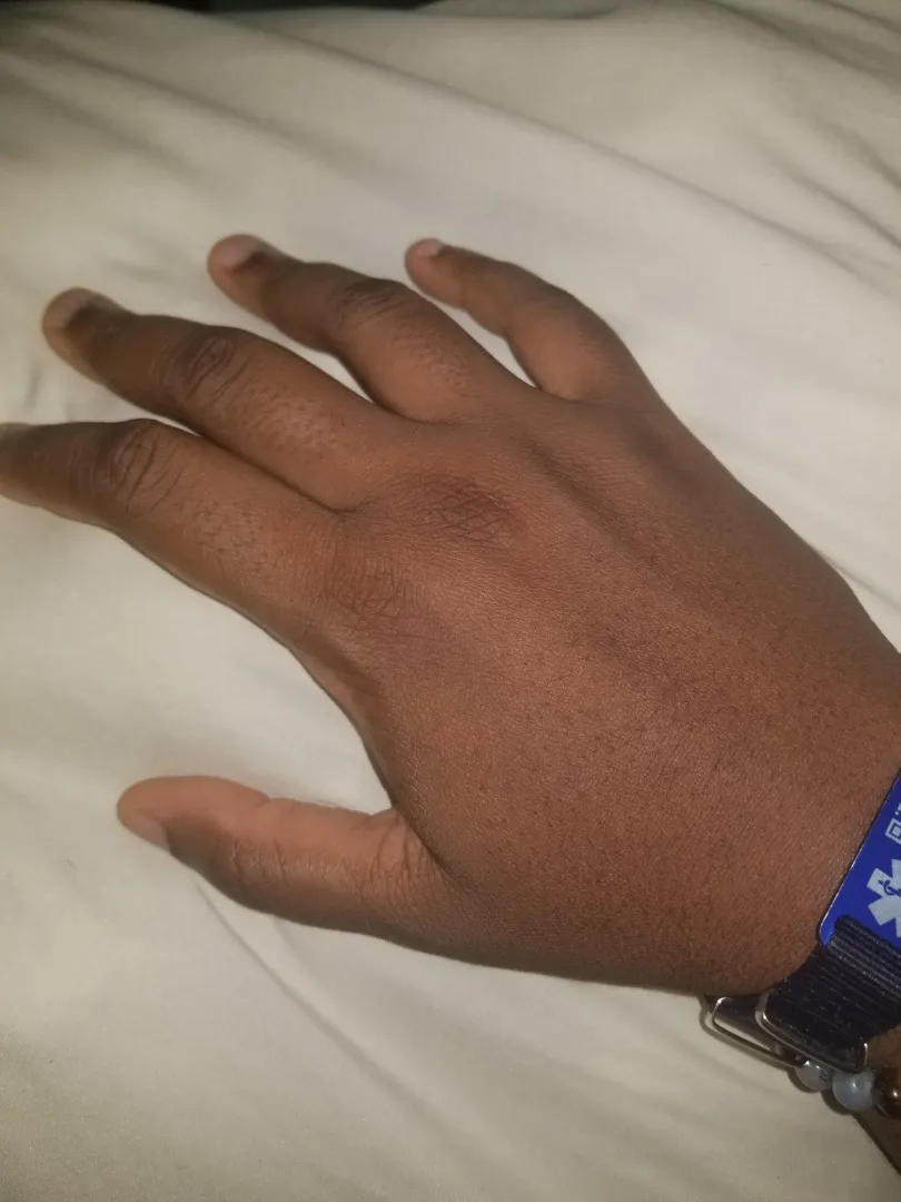 Slammed hand in door posted by awsomea21