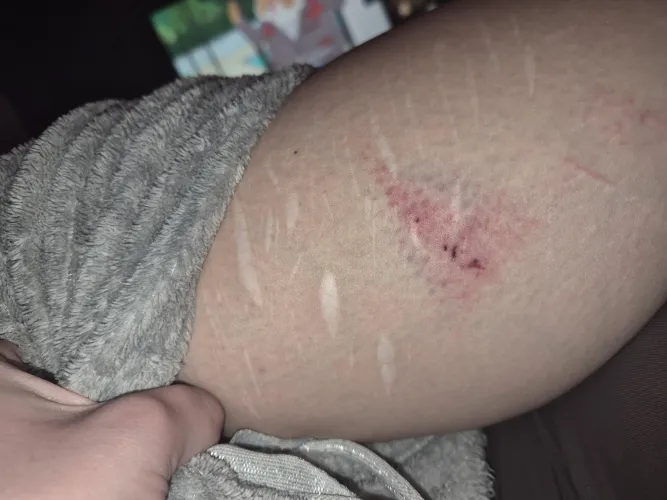 Smacked me leg on accident by saraonly420