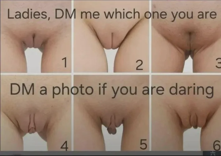 So curious of yours and anyone else you know by MediocreAttempt3635