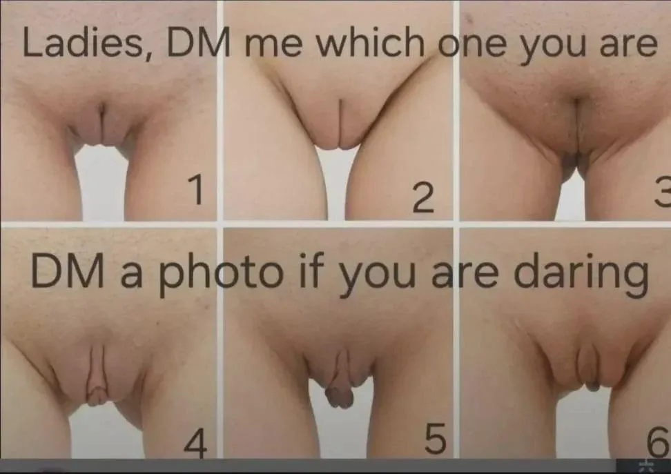 So curious of yours and anyone else you know posted by MediocreAttempt3635