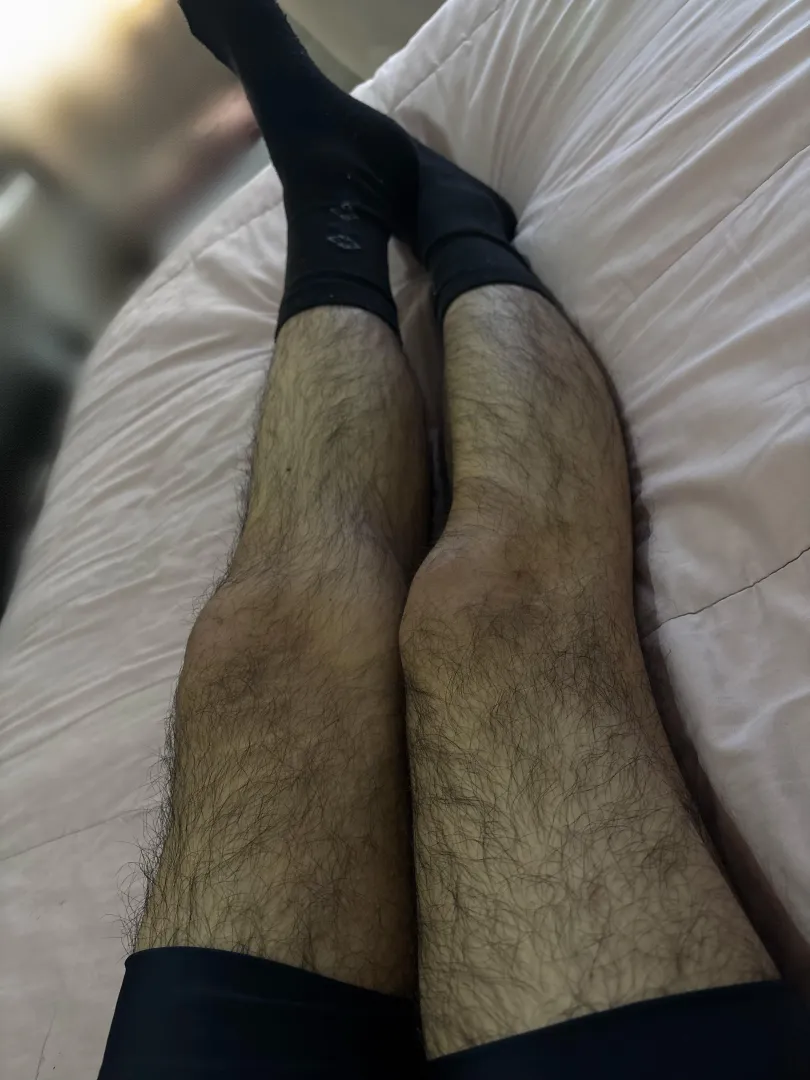 So Hairy Legs  posted by ErickXmS