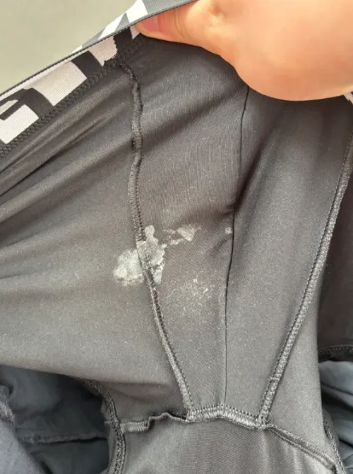 Sometimes this happens. Looking for guys who have it way worse by Honker13