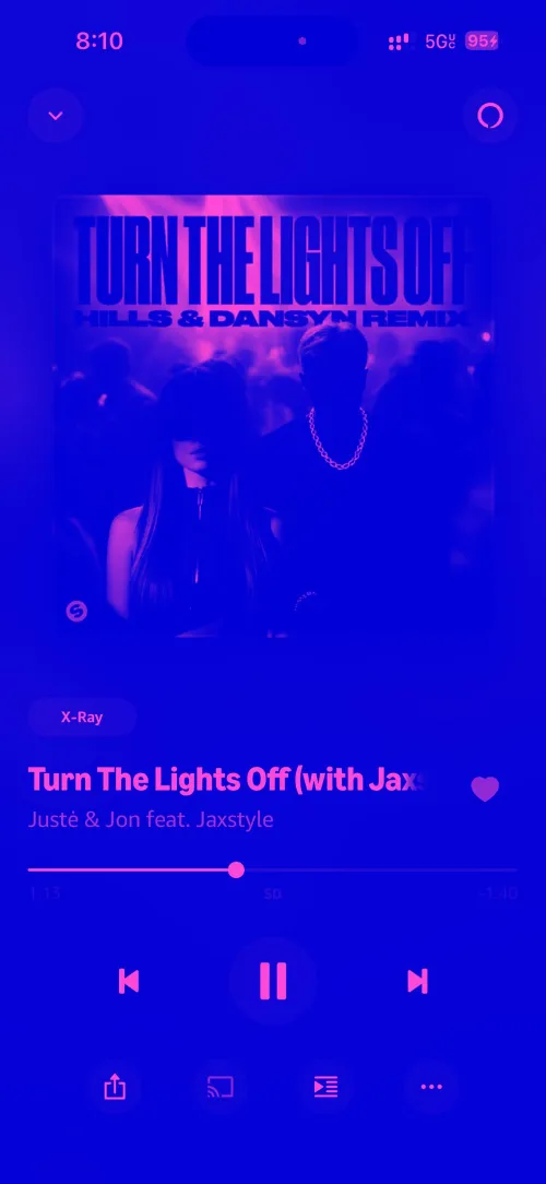 Sounds pumping directly into my brain …. by Ok-Collection8391