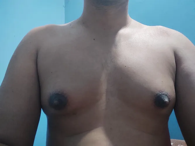 Started at 29. Currently am 33. on hrt on and off.What tanner stage is this. What is the cup size any guess!! by Greedy-Volume5487