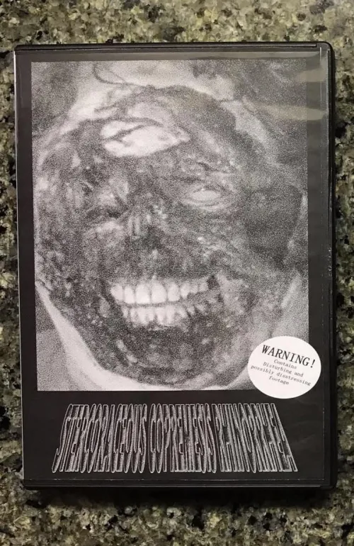 Stercoraceous Copremesis Rhinorrhea homemade mix tape/gorenoise performance. by s33dpeople