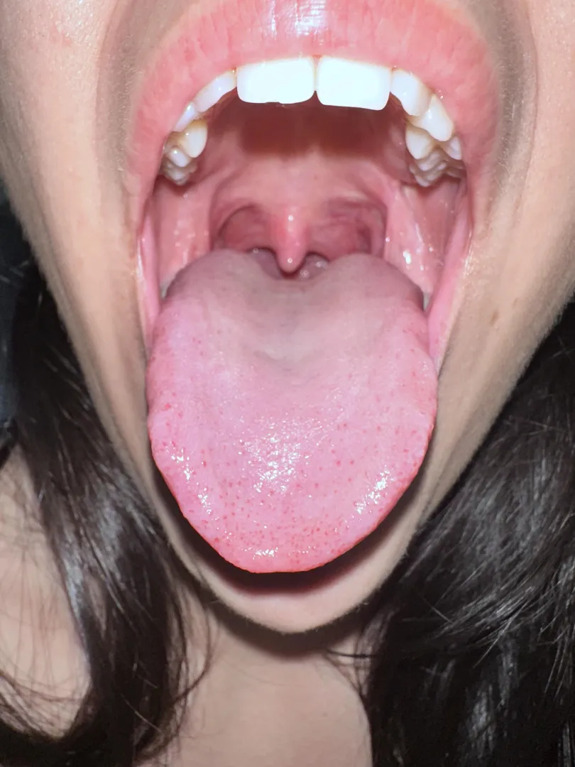 Stop! I'll eat you! posted by roxx_xieLov