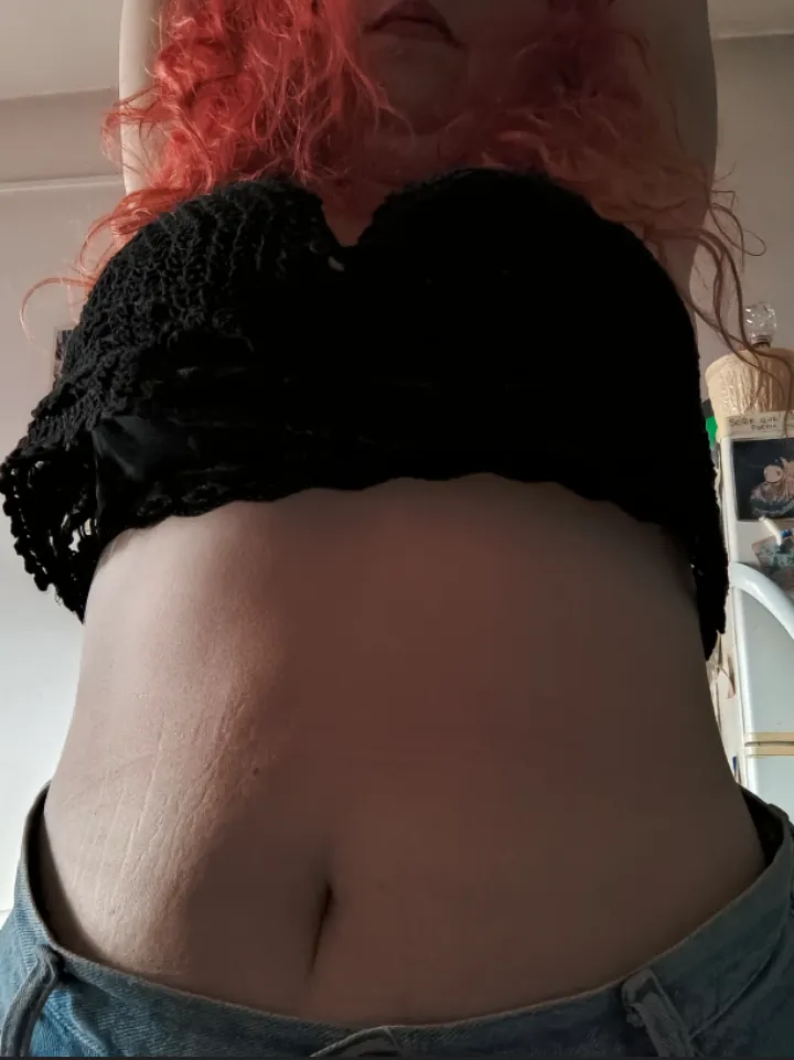 Stretching posted by Fancyblossom5