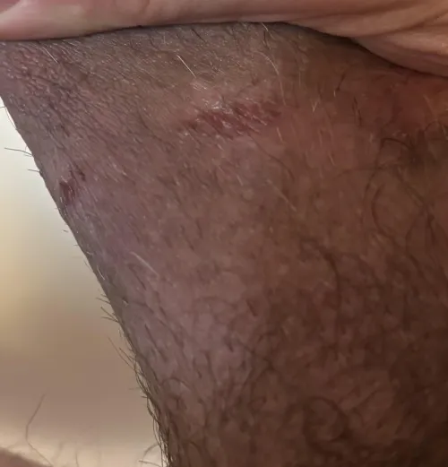 Stretching for sure…hold off or power through? by Possible-Win-7712