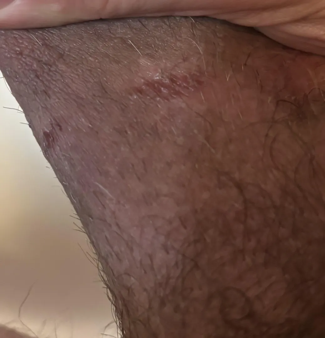 Stretching for sure…hold off or power through? posted by Possible-Win-7712