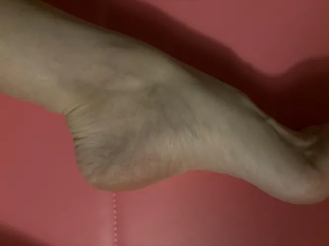 Stretching out ‍♀️ by Apprehensive-Tone511