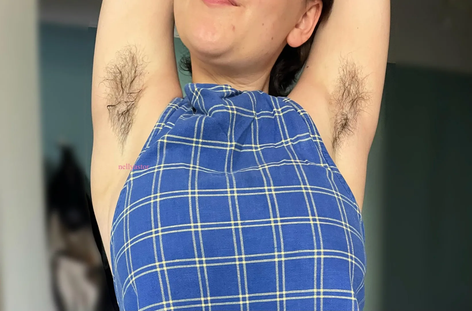 Thanks to hyperhidrosis, this is what my pits look like at any given moment  [hs] posted by NellyAstor