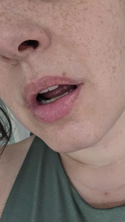 That freckle above my upper lip by GoodGirl_Lucy