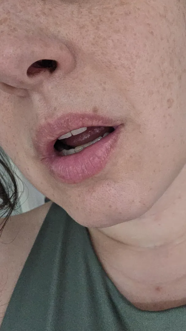 That freckle above my upper lip posted by GoodGirl_Lucy