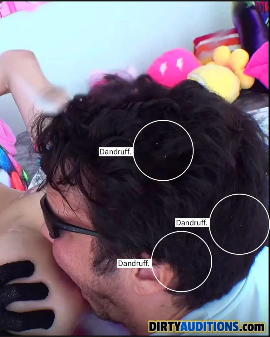 The Bison Head appears as if he jass woke up and his first routine was to ravage rectums layk luk, luk, luk aat that disheveled hair and those dandruffs!!!! posted by drinkpea_