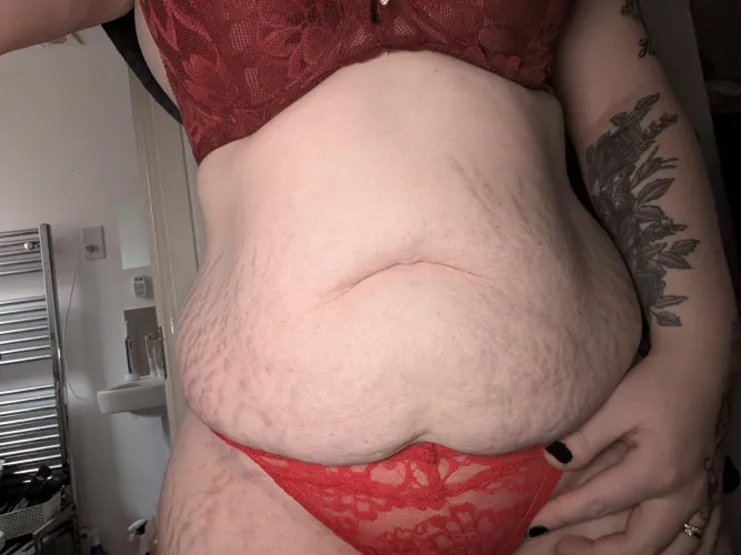 The strechmarks are more prominent if I use the flash on my camera by Ready-Pie-3107