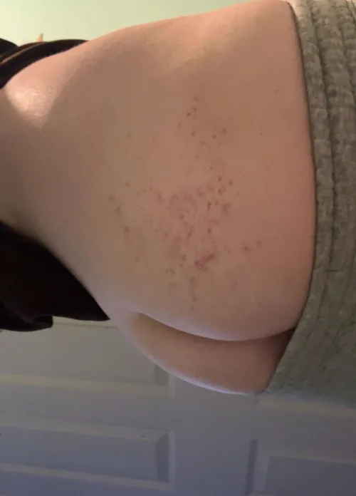 the tiniest marks he left on me.. wish he would go a little harder  i can handle it.. by No-Yesterday8839