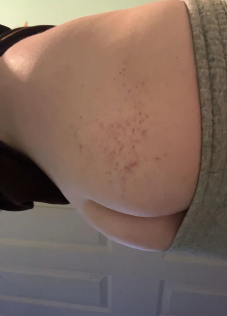 the tiniest marks he left on me.. wish he would go a little harder  i can handle it.. posted by No-Yesterday8839