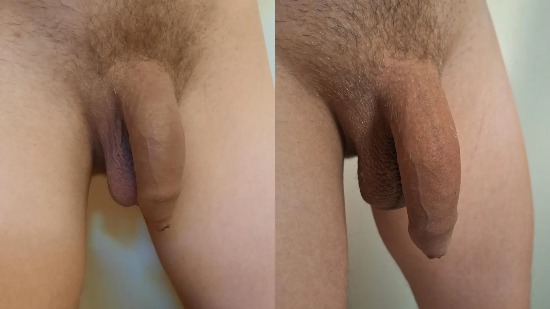 These pics are showing how my softie has evolved over the last 3-4 years posted by Low-Fox-3366