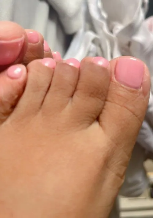 These toes look like candy. Wanna know how they taste by arboldebolas