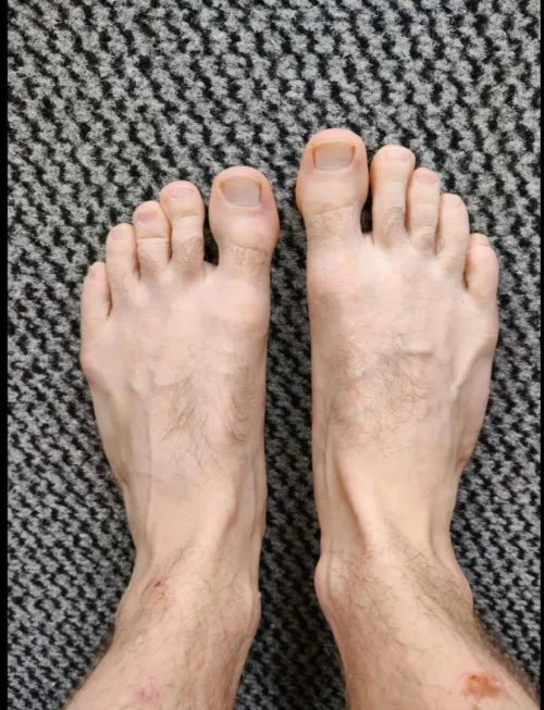 They need a massage by deeznutshagoti