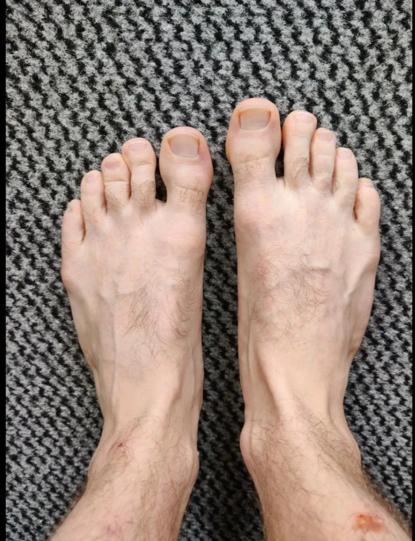 They need a massage posted by deeznutshagoti