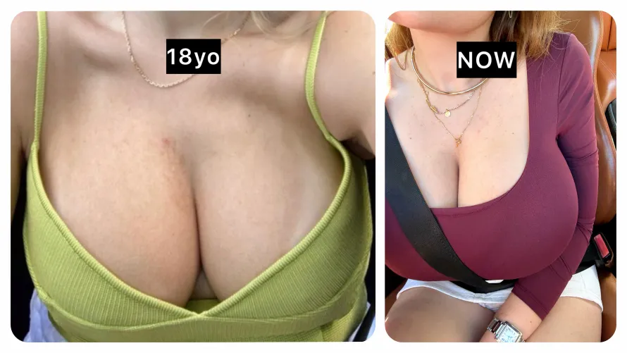 They were big, now they are insanely HUGE by closer2chloe1