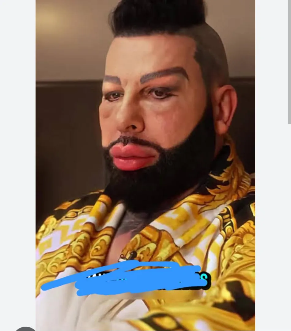 This guy posted by Brief_Mango_5829