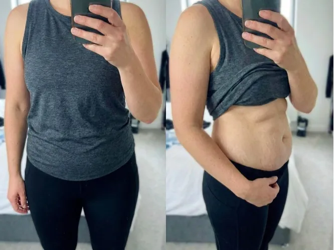 This tummy turned 40 today by annasecretly