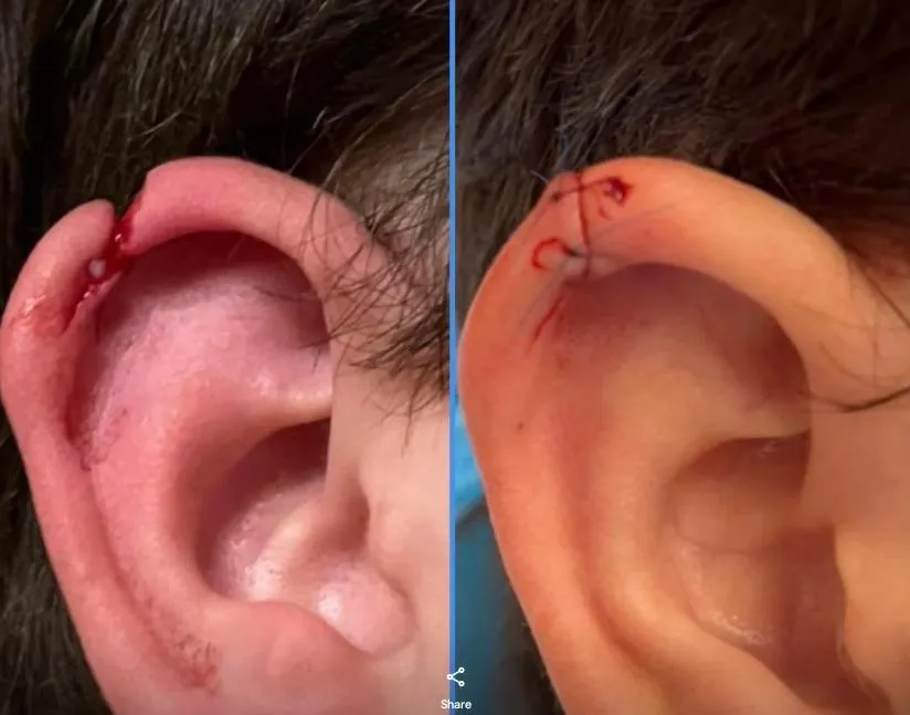 This was not fun posted by heywhatsupp_