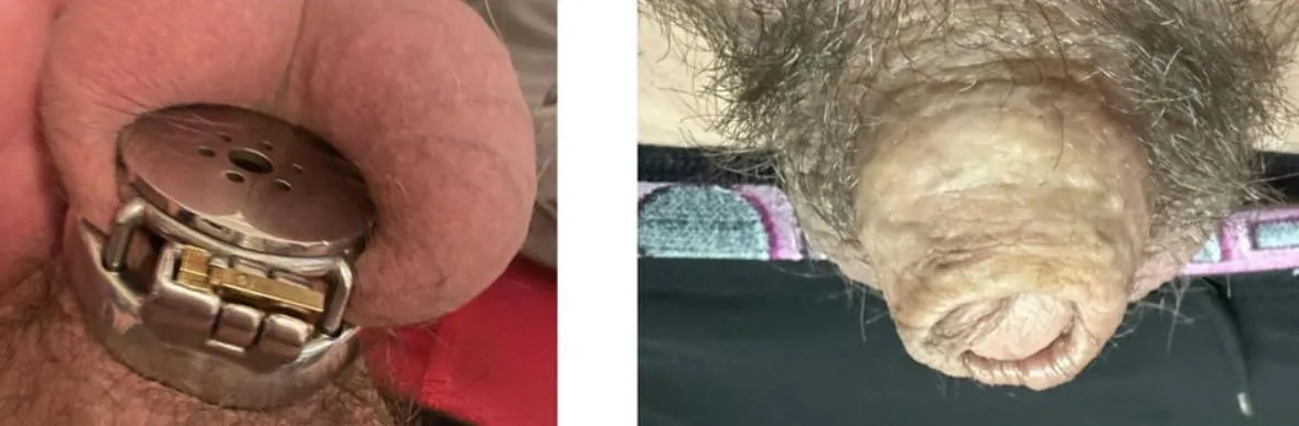 Thoughts? posted by Chastity_cuckold_69