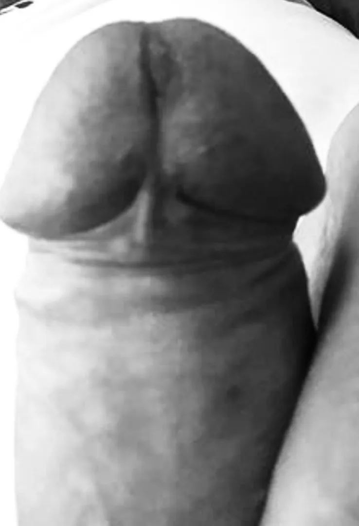 Throbbing head posted by simmo6974