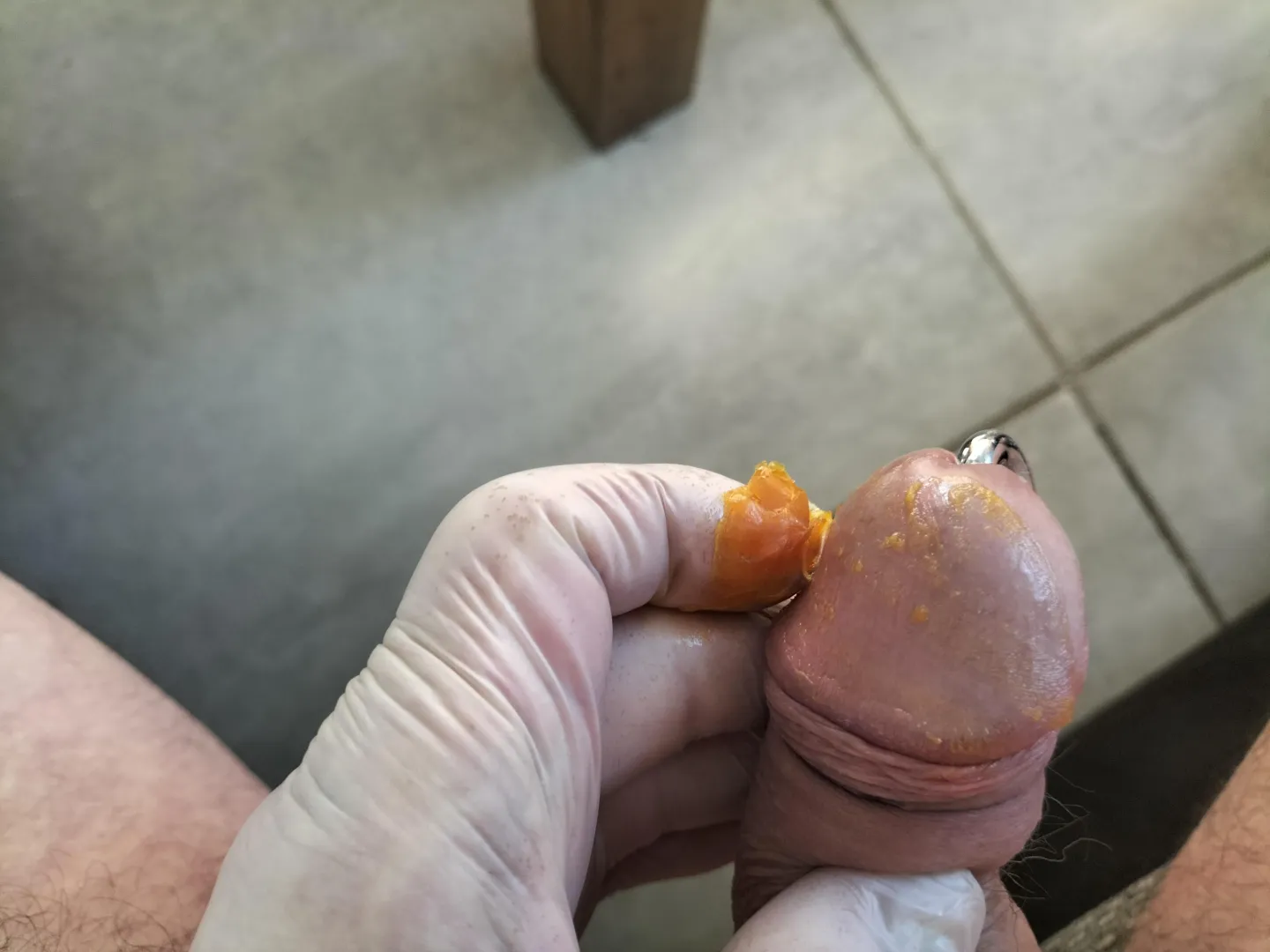 Tigerbalm on my glans posted by fetischguy57