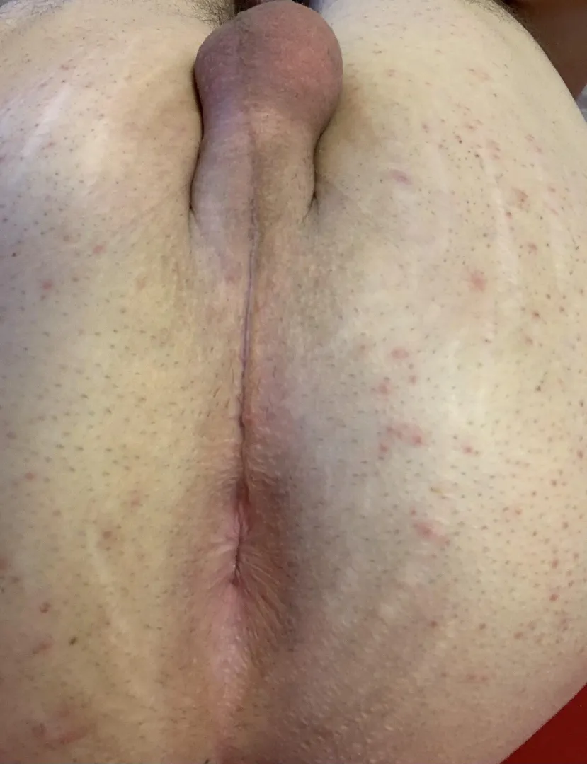 Tight little hole posted by Neither-Dish501